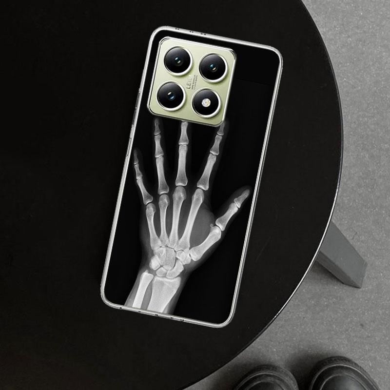 Autumu X Ray Hand Bones Phone Case Cover for Xiaomi Redmi Note 15 14 13 12 11 Pro Plus 14S 12S 11S 11T 11E 10S 10 Customized Fun