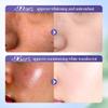 Luxury Blueberry Hyaluronic Acid Essence Moisturizing 6-piece Anti-Wrinkle Repair Whitening Freckle Removing Skin Care Set
