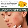 Woodsleep Calendula Care Essential Oil Reduces Scar Skin Redness, Moisturizes, Smooths And Tightens The Skin