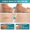 Silicone Scar Sheets, Silicone Scar Tape(1.6” X 120” Roll-3M), Scar Removal Away Strips for Surgical Scars, Keloid, C-Section, Burn Et