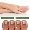 Medi-care Toenail Stick, Nails Soft Nails Nails Massage Nails Care B