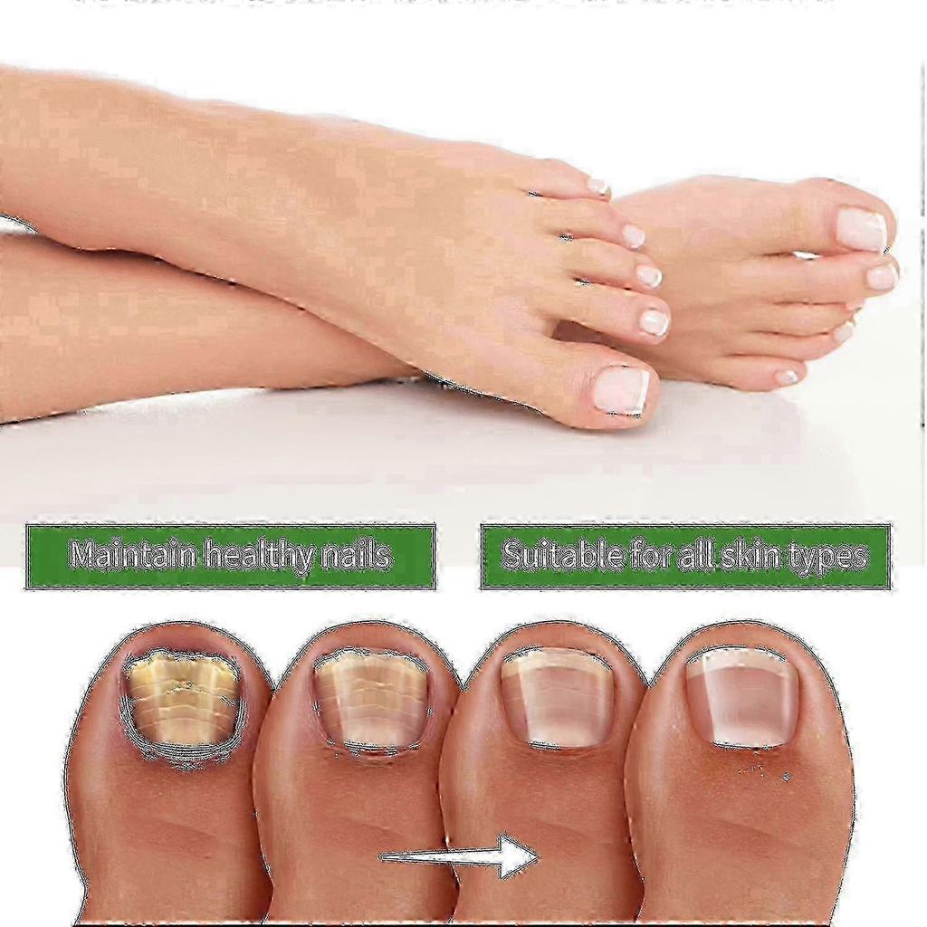 Medi-care Toenail Stick, Nails Soft Nails Nails Massage Nails Care B