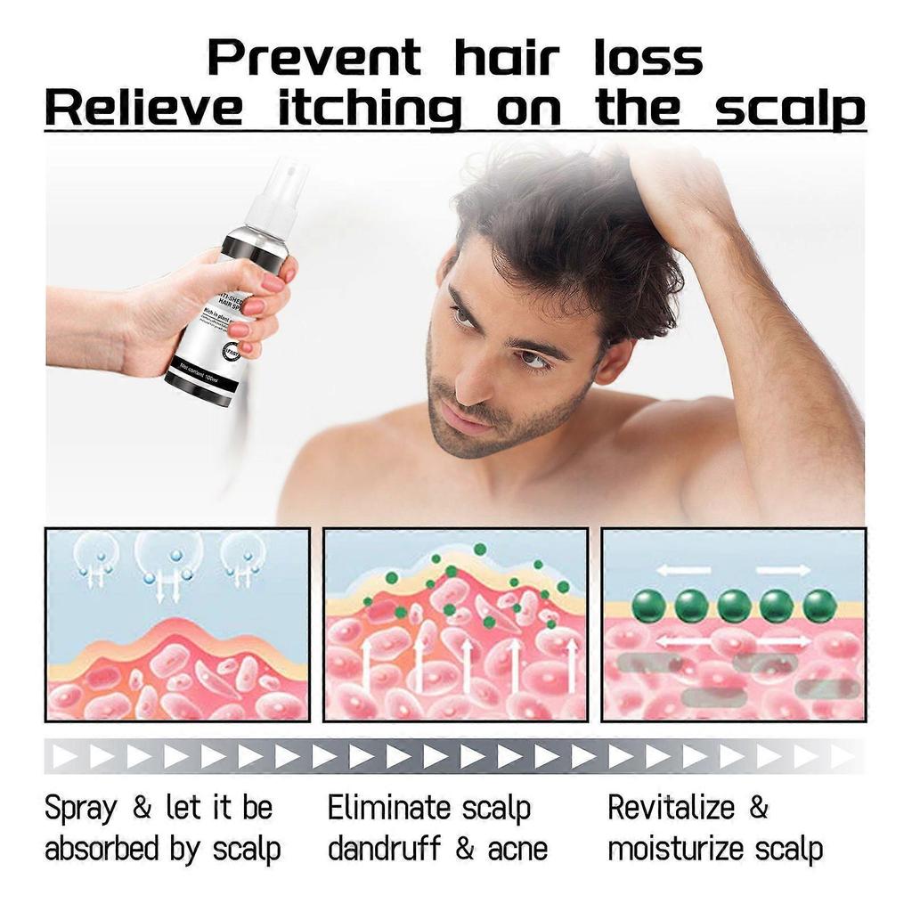 West & Month Anti-Hair Loss Spray - Improves Hairline, Thickens Hair, Strengthens Hair Roots, Nourishes And Moisturizes Hair