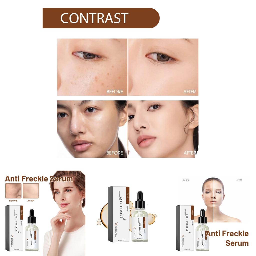 Hoygi Niacinamide Spot Brightening Serum Hydrating And Nourishing Skin Treatment For Dark Spots And Dull Complexion