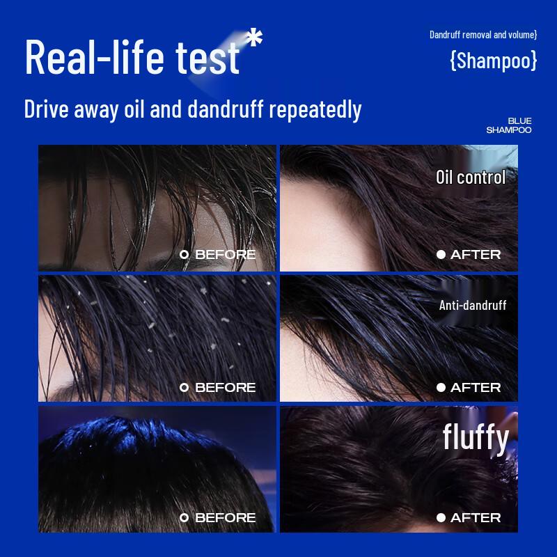 Zunlan Selenium Sulfide Anti-Dandruff Shampoo