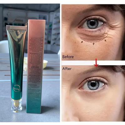 Retinol A Ester Ensoothe Nourishing, Hydrating and Tightening Eye Repair Cream Desalinates Fine Lines