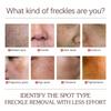 Spots Peel Off Facial Mask Freckle Pigmentation Removal Cream Chloasma Care Dark Spot Correction Glow Whiten Peeling Mask Strong