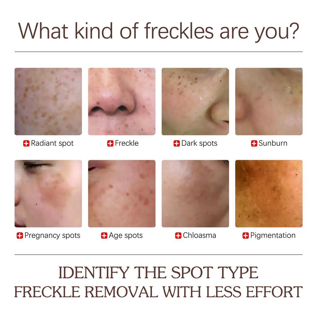 Spots Peel Off Facial Mask Freckle Pigmentation Removal Cream Chloasma Care Dark Spot Correction Glow Whiten Peeling Mask Strong