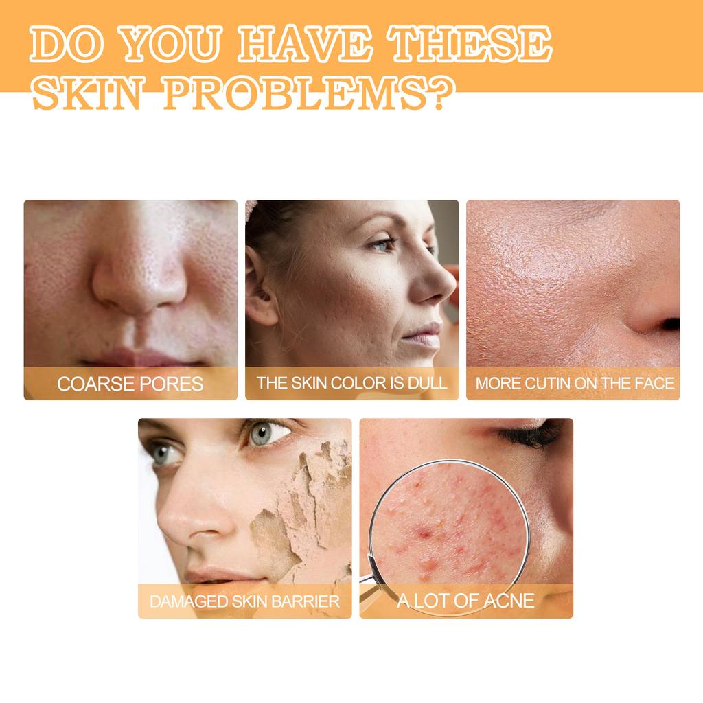 EELHOE Glykolsäure 7 % Toner Make-up Wasser Tonic Feuchtigkeitsspendende ausgleichende Hautpflegelotion Ölkontrollierende Hyaluron-Essenz 100 ml