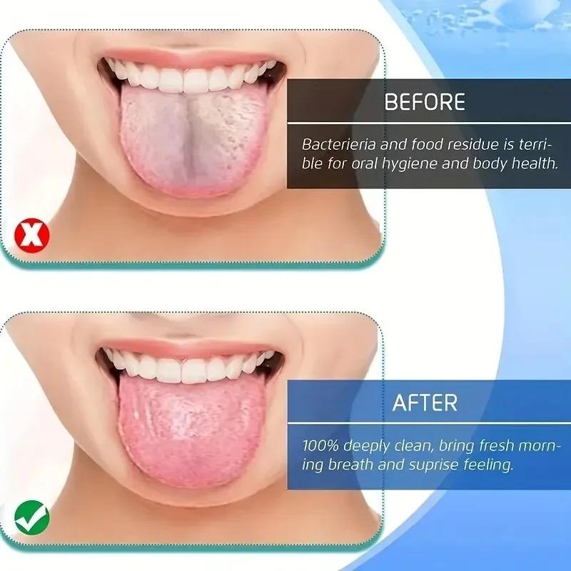 Stainless Steel 304 Material U-Shaped Metal Tongue Scraper For Fresh Breath Cleaning, Tongue Scraper, Tongue Brush, Oral Care