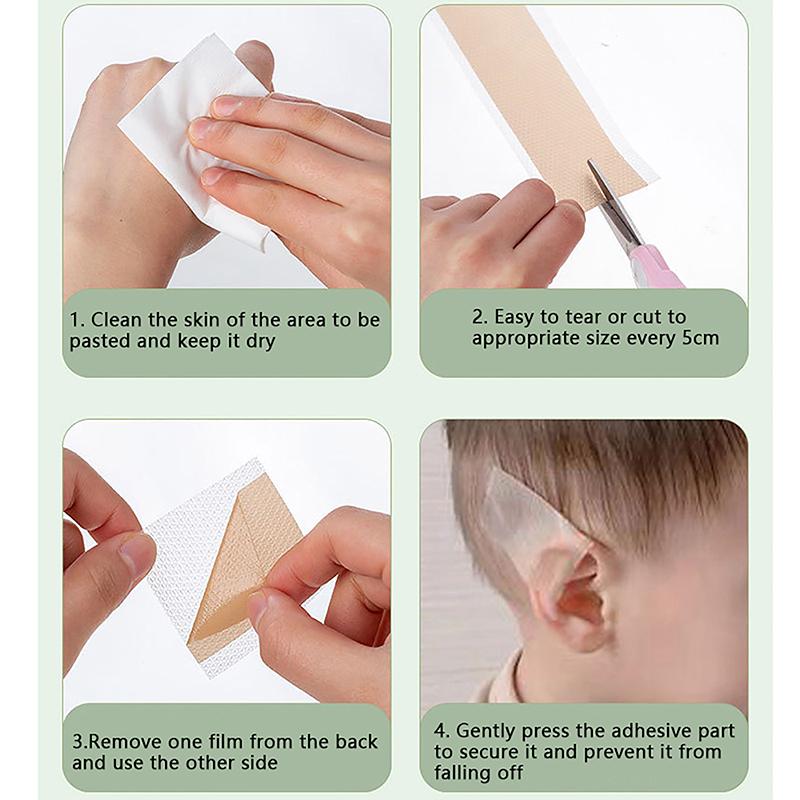 1.5M/Roll Baby Ear Corrector Infant Protruding Ears Correction Silicone Kids Ear Aesthetic Correctors Patch Sticker Ear Care