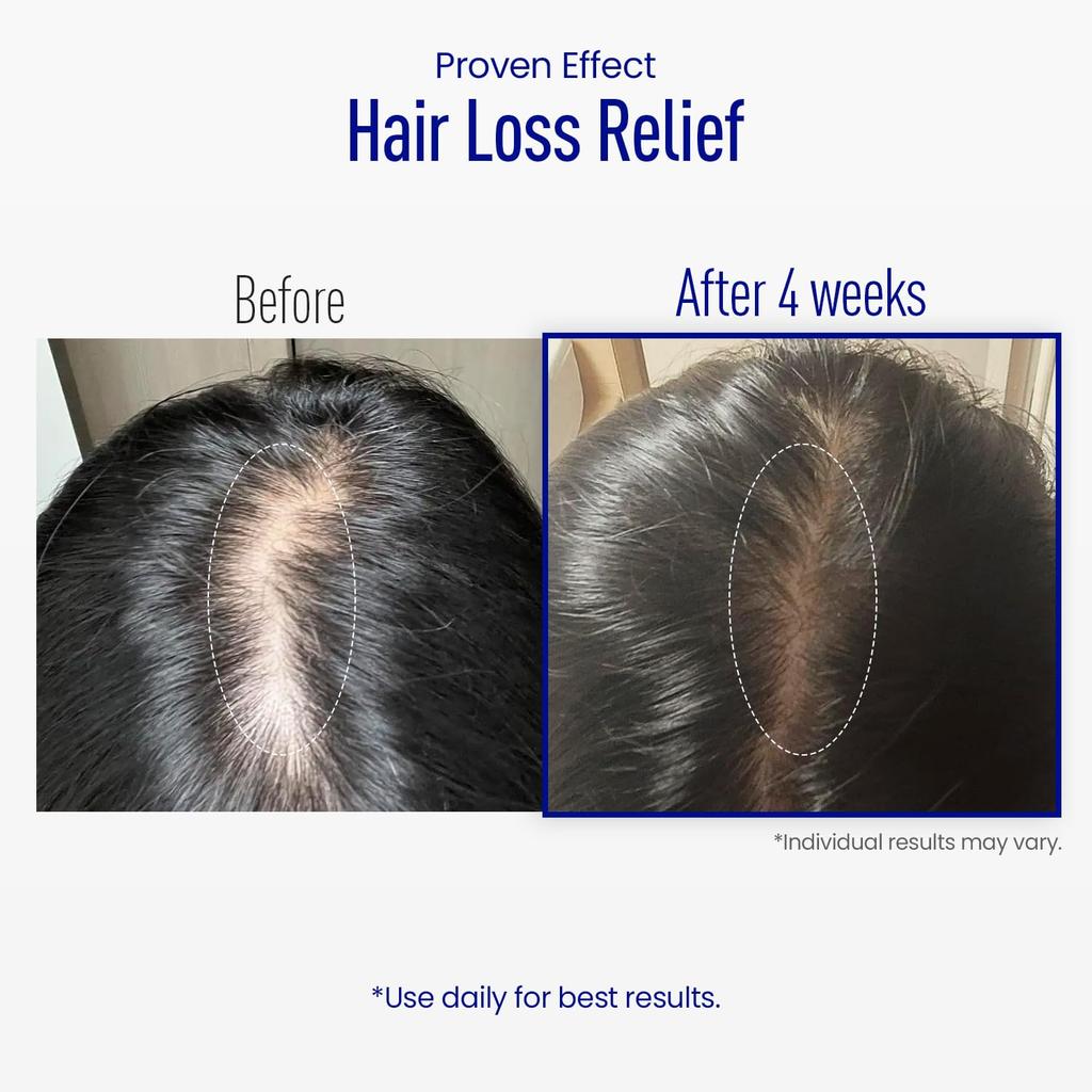 ViveLab Scalp Spioxyl React Shot 400 15ml