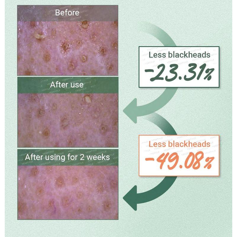 numbuzin - No.3 Pore & Makeup Cleansing Balm With Green Tea And Charcoal