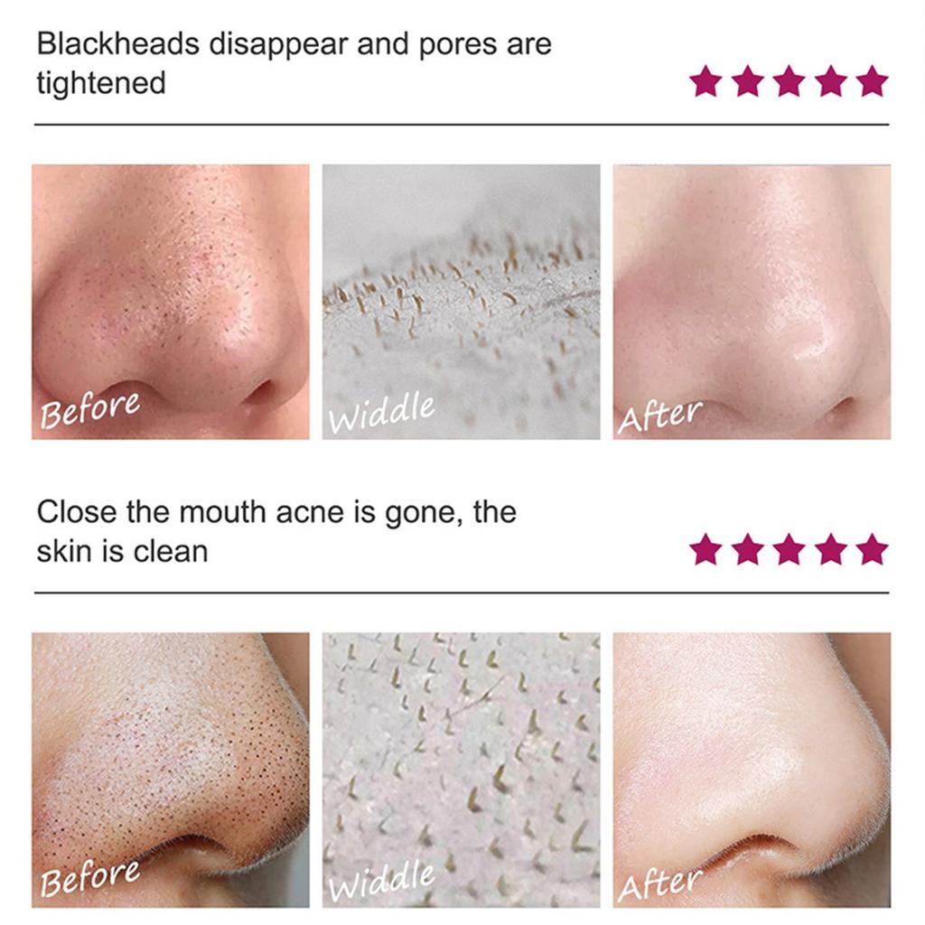 Blackhead Removal Mask, Exfoliating Nasal Mask Patch, Peel-Off Mask Suitable For All Skin Types,10ML