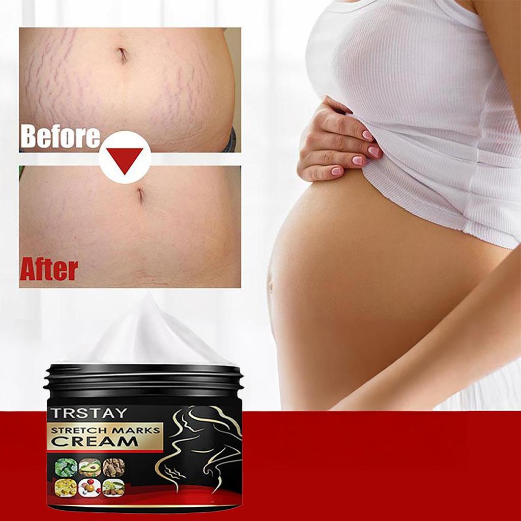 Fade Repair Scar Repair Cream Is Suitable for Care of Stretch Marks and Pregnant Skin