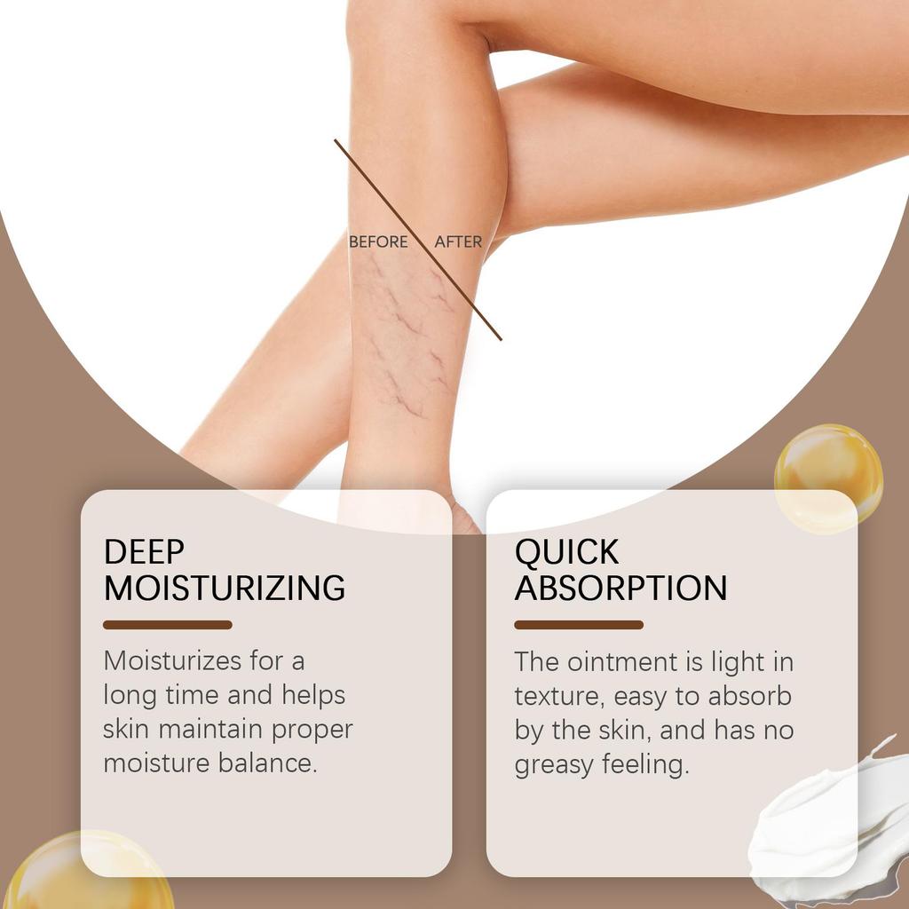 Varicose Veins Ointment Eliminate Spider Legs Vein Relieve Vasculitis Phlebitis Massage Moisturizing Legs Pain Treatment Cream