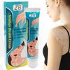 ZB Powerful Cream Treatment for Vitiligo and Skin Discoloration Reduce White Spots, Improve Skin Pigmentation