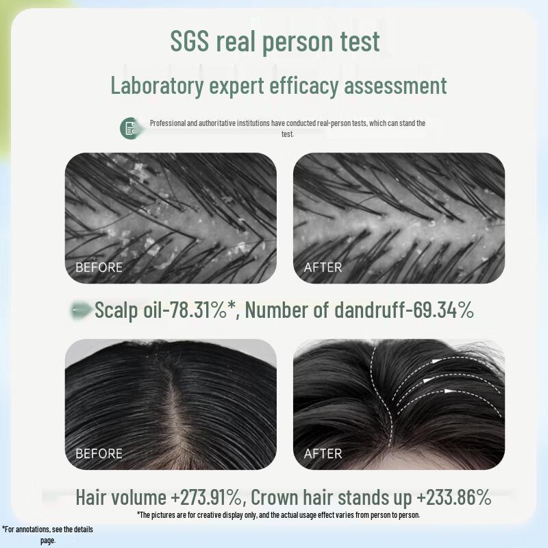 Kangaroo Mama Teen Anti-Dandruff Oil Control Shampoo