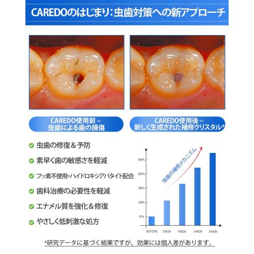 CAREDO Adult Toothpaste, Cavity Prevention & Treatment, Fluoride-Free, Hydroxyapatite, Tartar Removal, Waterless, Enamel Repair, Filling Support, 100g