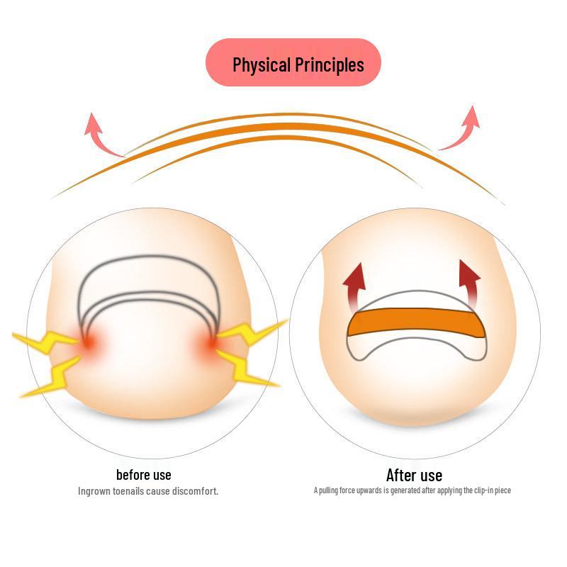 Nail Care Set: Cuticle Pusher, Nail File, Manicure Brush, Nail Buffer, Ingrown Toe Sticker, Pedicure Tools