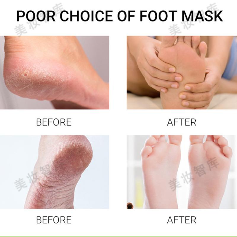 Avocado-Fußmaske, entfernt abgestorbene Hautzellen und spendet Feuchtigkeit, peelt und pflegt die Fußpflege