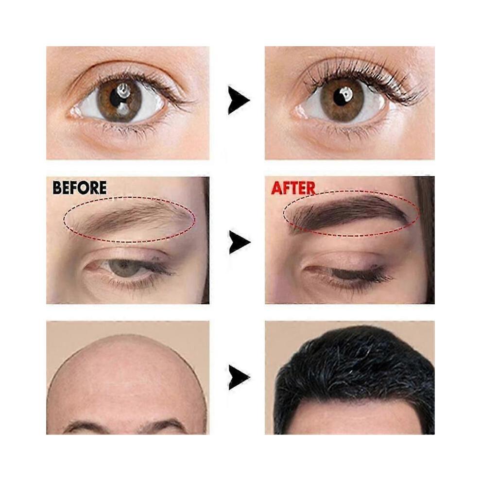 (1 Stück) Augenbrauenwachstumsflüssigkeit Schnell Für Männer Frauen Dicke Wimpern Wachsen NEU 2024