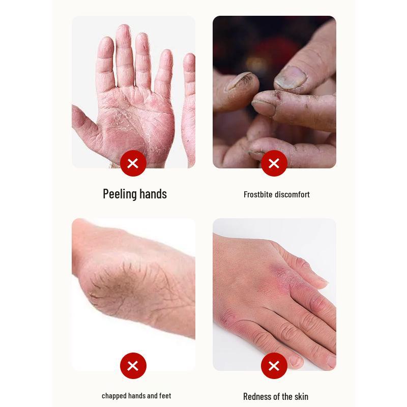 Cremă calmantă Qiuteng Meichuan pentru piele crăpată - Ameliorează crăpăturile și descuamarea