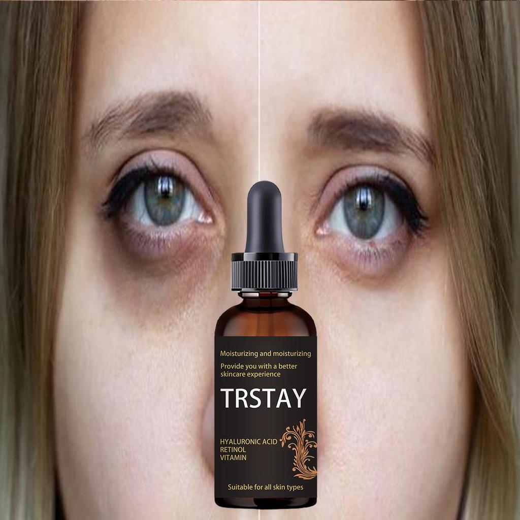 Reduce Fine Lines Improve Dark Circles Anti Puffiness Anti Aging Eye Cream