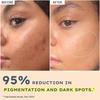 Hyphen 44% Rice Water Brightening Face Serum Pads | 5% Niacinamide & Alpha Arbutin to Reduces Dark Spots & Pigmentation | All Skin Types - 50N