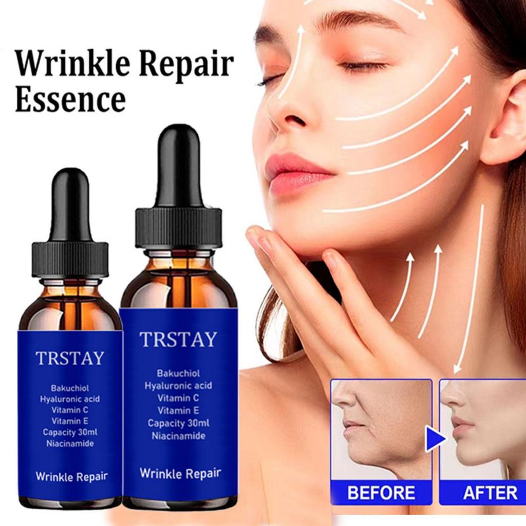 5G/15G/30G/50G/TRSTAY Kollagen Anti-falten Creme Retinol gesicht creme Feuchtigkeitsspendende Creme Haut Weichmachende gesicht creme