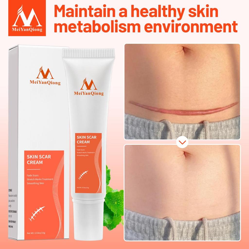 Acne Removal Cream Skin Repair Face Cream Acne Spots Acne Blackhead Whitening Cream