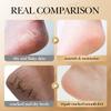 SAODER Collagen Foot Cream Feet Skincare Moisturizing Hydrating Firming Nourishing Repairing Feet Creams Foot Skin Care Products