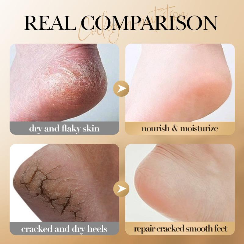 SAODER Collagen Foot Cream Feet Skincare Moisturizing Hydrating Firming Nourishing Repairing Feet Creams Foot Skin Care Products