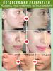 Cream for facial inflammation, acne and blackheads, for oily and problem skin, suitable for teenagers and adults, 15 g