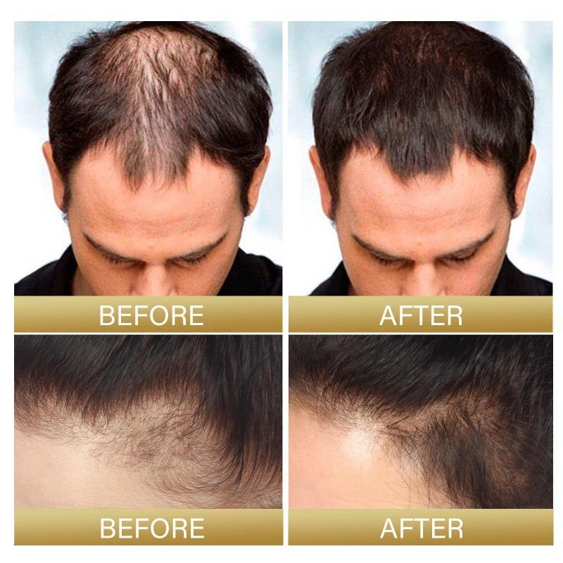 30 ml dichtes Haarspray spendet der Kopfhaut tiefenwirksam Feuchtigkeit, repariert das Haar, festigt das Haar und ist kompaktes Haarspray
