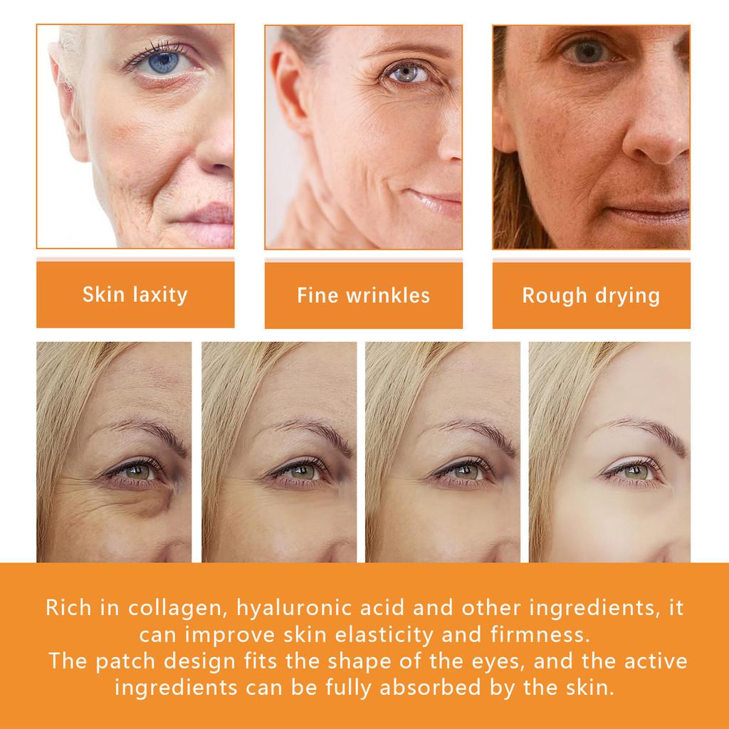 Ouhoe Collagen Eye Masks 10 Pieces Deep Hydrating Formula For Youthful Skin