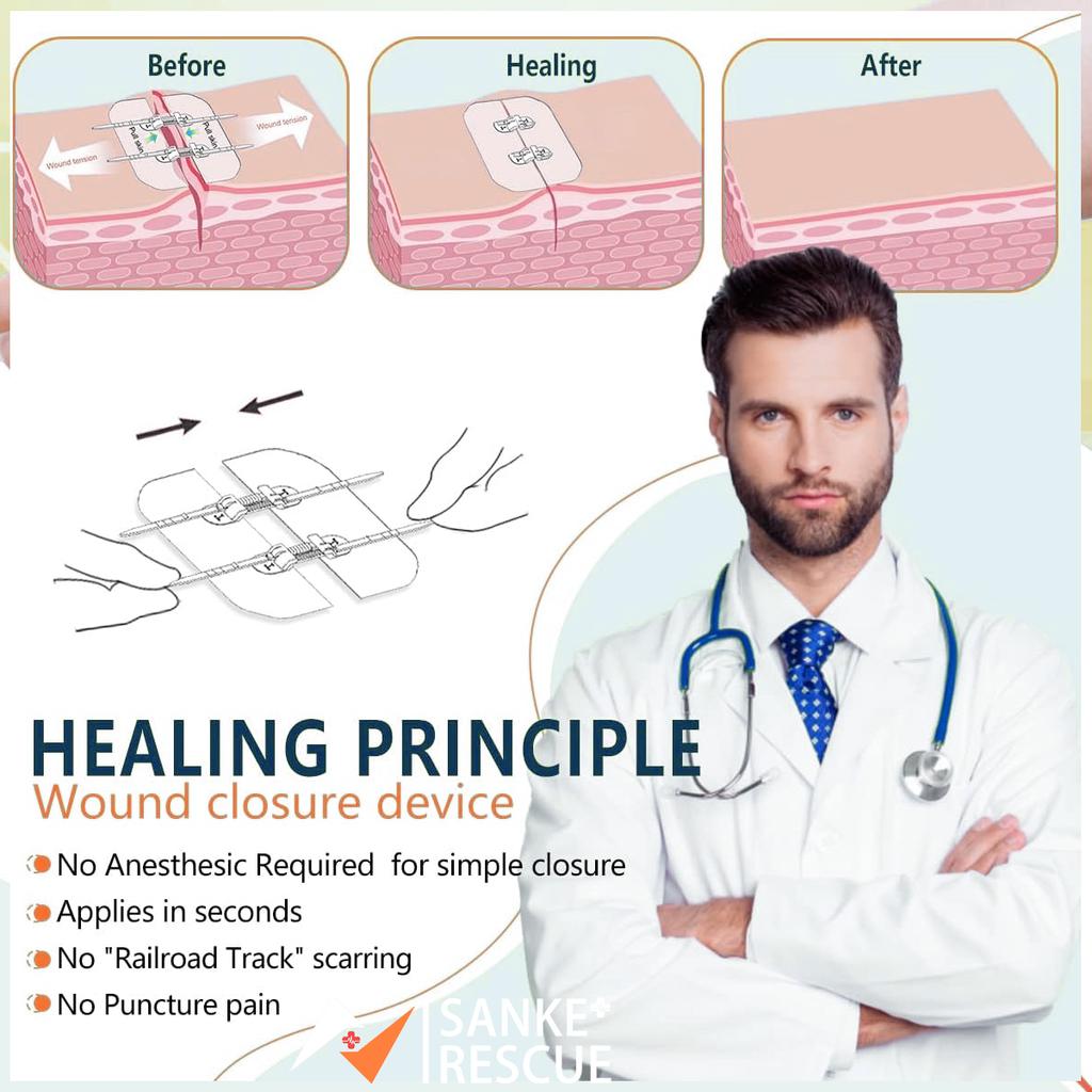 2-4PCS Zipper Painless Wound Closure Device Suture-free Wound Dressing Closure Strips Kit Emergency Laceration Closures for Ifak