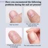 Unhas falsas – Pontas e unhas postiças
