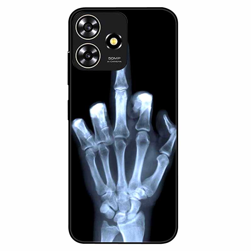 For ZTE Blade V50 Smart Case Phone Cover Shockproof TPU Soft Silicone Fundas for ZTE Axon 50 Lite 8050 V50Smart Luxury Coque