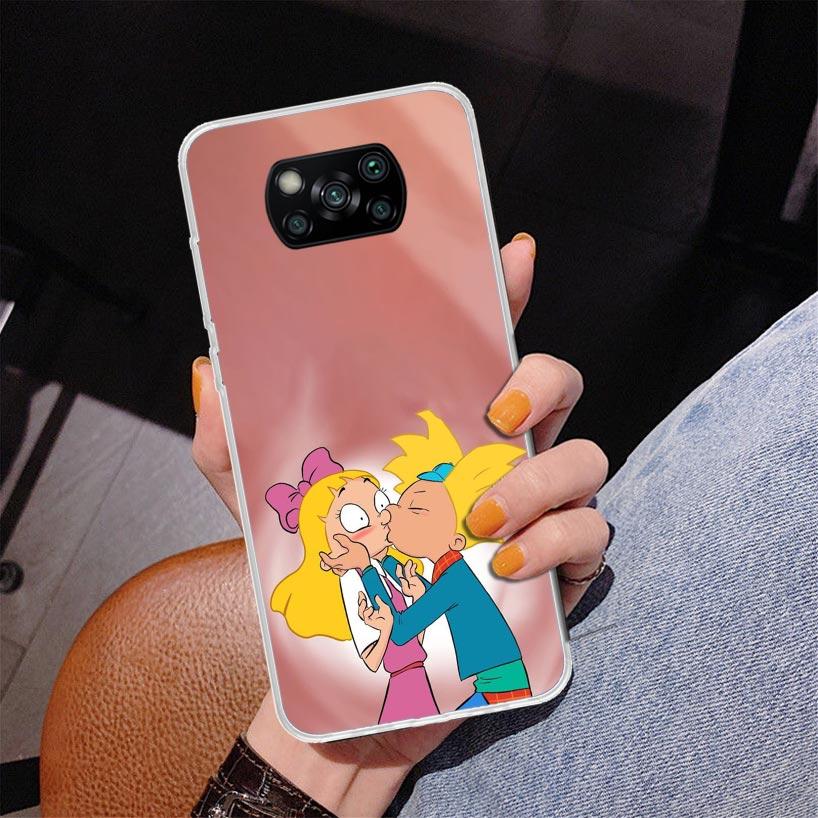 

Cartoon Hey Arnold Fondos Phnoe Case for Xiaomi Poco X5 X6 X7 Pro X4 Gt F7 Ultra M8 M7 Redmi 15C 15 13C 13 12C 12 Unique Cover C Redmi 10A