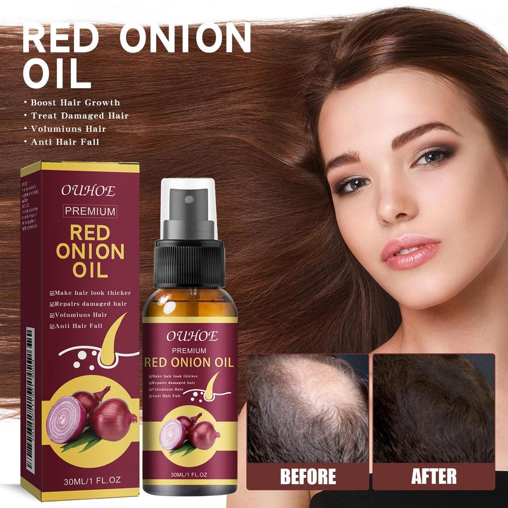 Red Onion Hair Growth Essential Oil Hair Care Spray Nourish Hair Roots Improve Hair Texture Hair Care Products