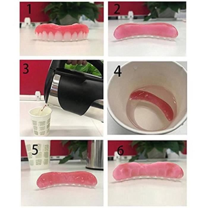 Cosmetic Teeth - MEHANO - XF01431 - Tooth Correction - In Stock - Perfect Smile