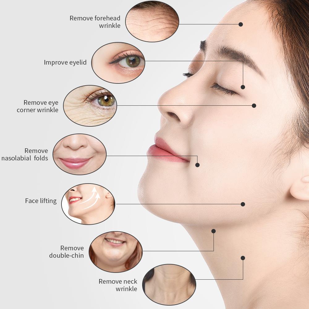 2MHz Tripolar Radio Frequency Face Body Skin Lifting Tightening Machine Eye Neck Anti-Wrinkle V-Face V-Line RF Beauty Device