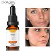 VC Gesichtsserum, Vitamin-C-Serum, Aufhellungscreme, erhellt die Haut, Gesichtspflege, feuchtigkeitsspendend, glättend, verblasst dunkle Flecken, entfernt Sommersprossen