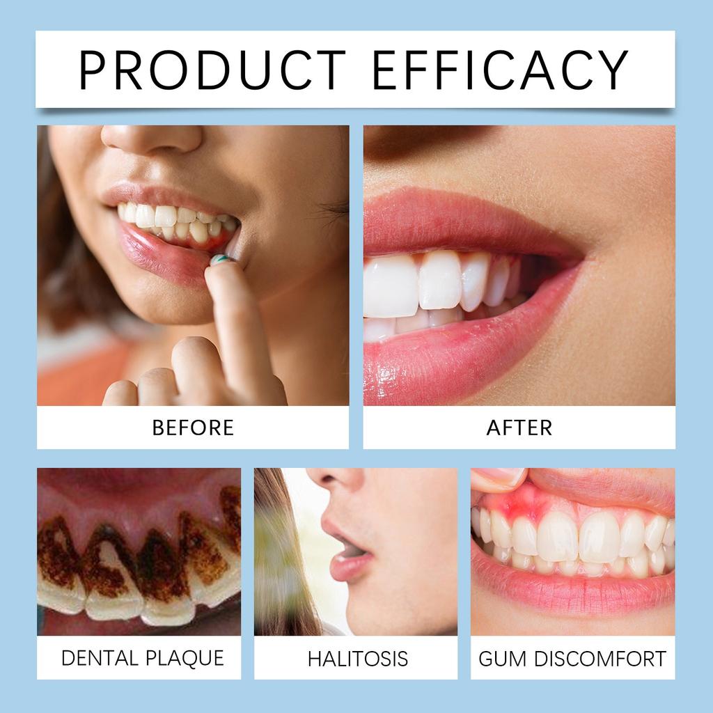 Munnpleiespray, Smertespray, Aftøse sårvev, Effektiv forebygging av tannpine, 20 ml