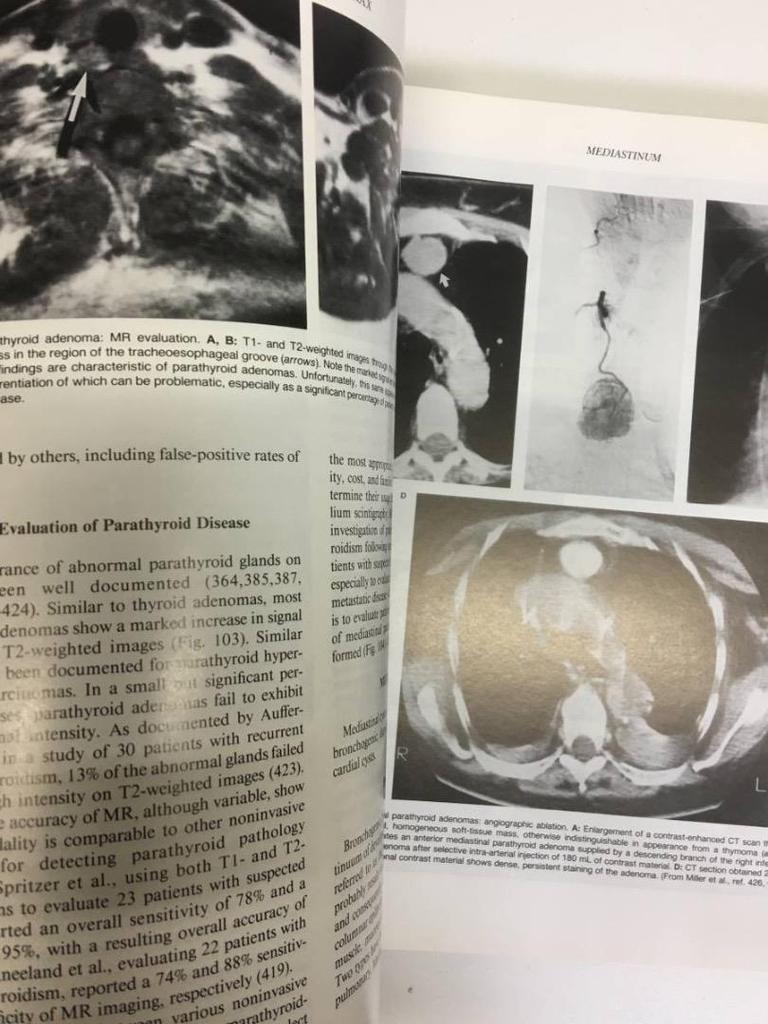 [USED] Hospital Disposal Book: Computed Tomography, Large-format Medical Book