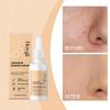 Hoygi Essence Facial Essence Moisturizing Spray Pore Shrinking Moisturizing Essence Repairing and Brightening Skin Care Product