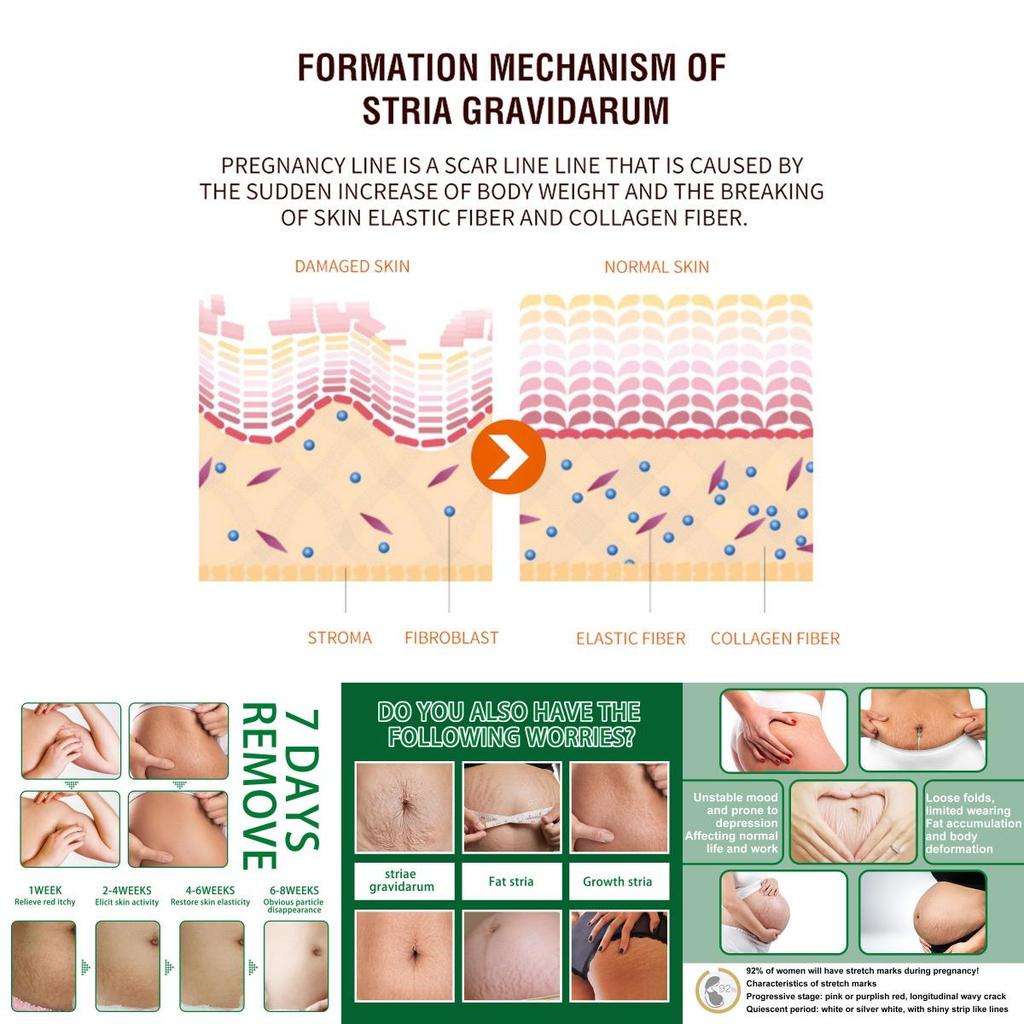 Jaysuing Skin Care Spray For Postpartum Skin Firming And Fine Line Reduction In 30ml Packaging