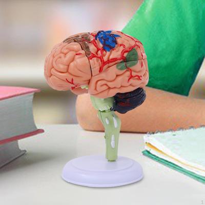 4D Disassembled Anatomically Model Human Brain Anatomy Easy To Use Puzzle Desk Figure for