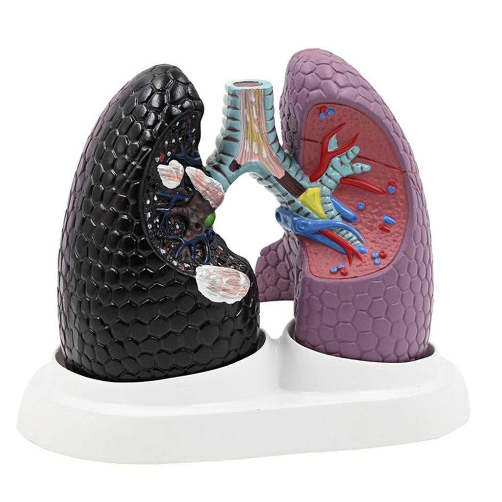 Anatomical Pathological Lung Model Human Lung Anatomy Model Normal and Pathological Lung Anatomy Model for Teaching Tool